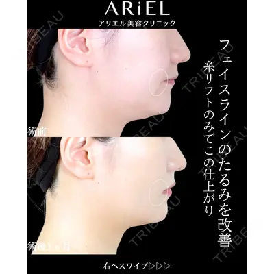 アリエル美容クリニック 横浜院 渡邉 光医師の症例
