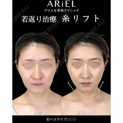 アリエル美容クリニック 横浜院 渡邉 光医師の症例
