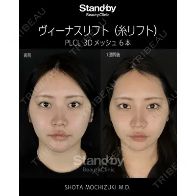 Stand by Beauty Clinic 望月 聖太医師の症例