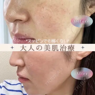 BISIN GINZA CLINICの症例
