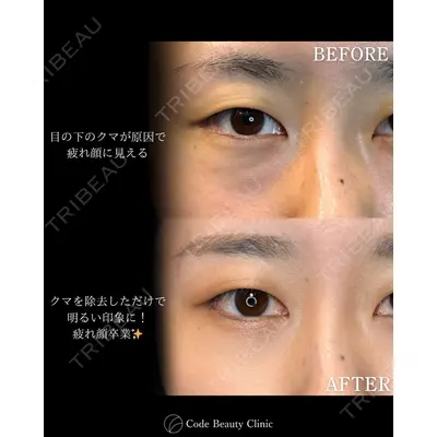 Code Beauty Clinic 名古屋院 橋本 祥平医師の症例