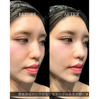 Code Beauty Clinic 名古屋院 橋本 祥平医師の症例