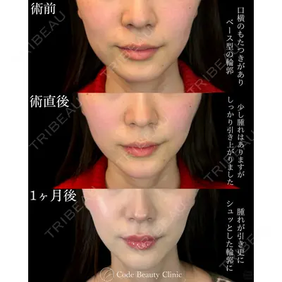 Code Beauty Clinic 名古屋院 橋本 祥平医師の症例