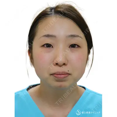 聖心美容クリニック 熱海院 小林 美幸（皮膚科）医師の症例