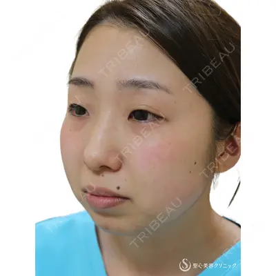 聖心美容クリニック 熱海院 小林 美幸（皮膚科）医師の症例
