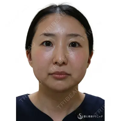 聖心美容クリニック 熱海院 小林 美幸（皮膚科）医師の症例