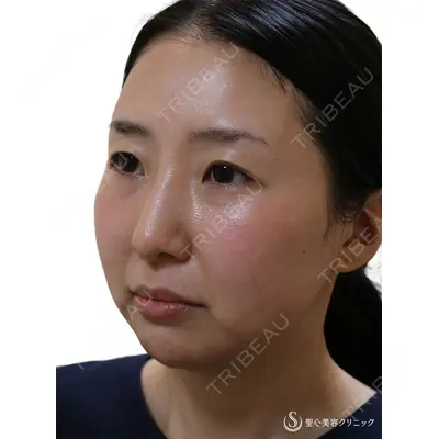 聖心美容クリニック 熱海院 小林 美幸（皮膚科）医師の症例