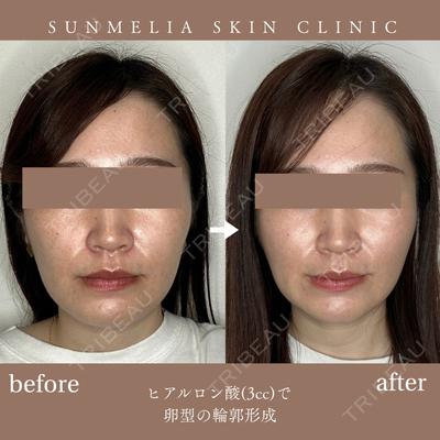 SUNMELIA SKIN CLINIC 中山 暁医師の症例