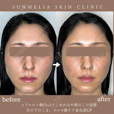 SUNMELIA SKIN CLINIC 中山 暁医師の症例