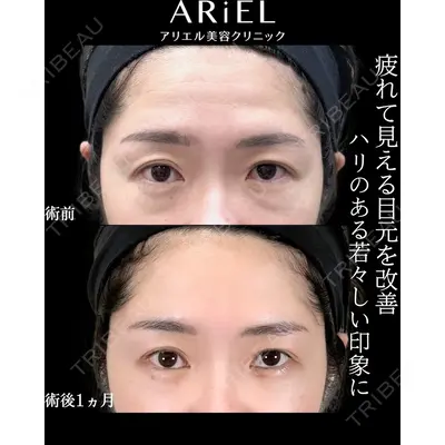 アリエル美容クリニック 横浜院 渡邉 光医師の症例