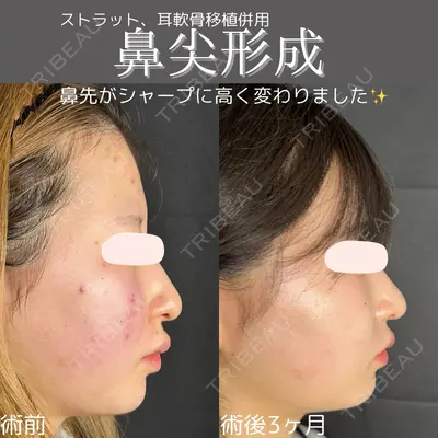 ルラ美容クリニック 仙台院 / ルラスキンクリニック 仙台院 橋本 英樹医師の症例