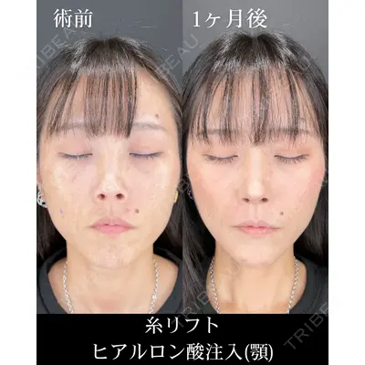 HAAB×DREAM BEAUTY CLINIC 大阪梅田院 柏木 太雅医師の症例