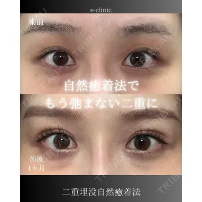 eクリニック 大阪院 八木 良太医師の症例
