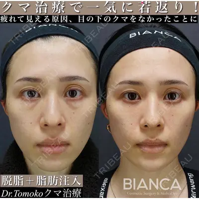 BIANCA表参道 松田 朋子医師の症例
