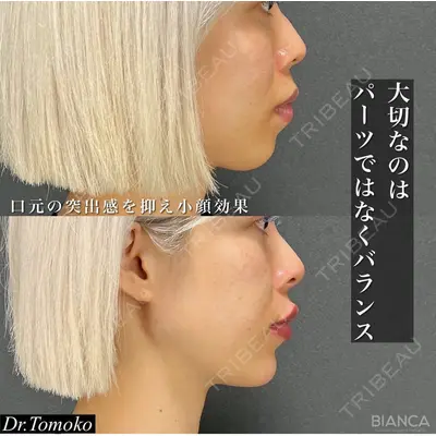 BIANCA表参道 松田 朋子医師の症例