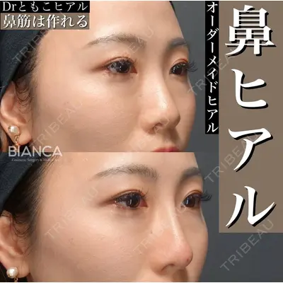BIANCA表参道 松田 朋子医師の症例