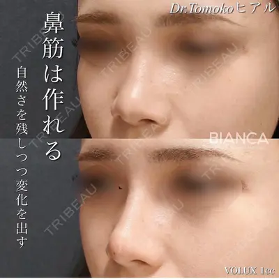 BIANCA表参道 松田 朋子医師の症例