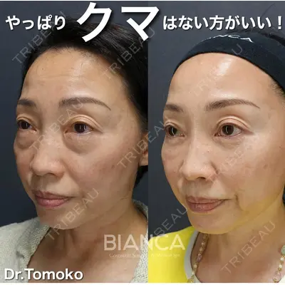 BIANCA表参道 松田 朋子医師の症例