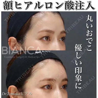 BIANCA表参道 松田 朋子医師の症例