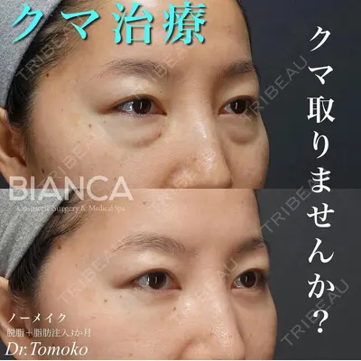 BIANCA表参道 松田 朋子医師の症例