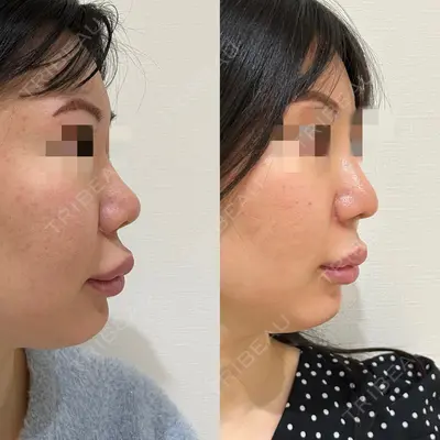 エターナル美容クリニック 久門田 詳医師の症例