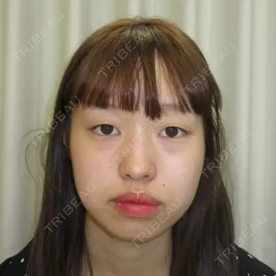 渋谷美容外科クリニック 新宿院 野口 なつ美医師の症例
