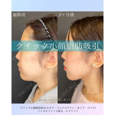 ルラ美容クリニック 札幌本院 佐藤 雄紀医師の症例