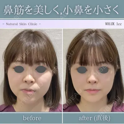 Natural Skin Clinic 笹塚院 圓山 尚医師の症例