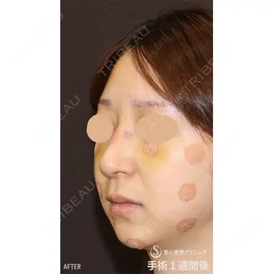 聖心美容クリニック 銀座院 牧野 陽二郎医師の症例