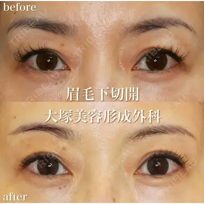 大塚美容形成外科 銀座本院 石井秀典医師の症例