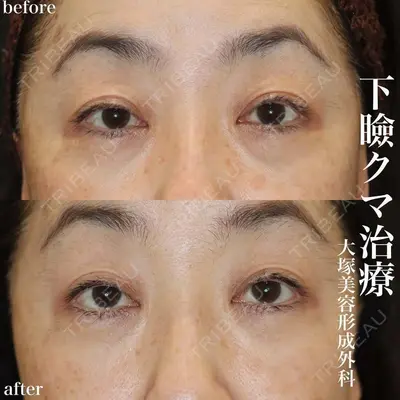 大塚美容形成外科 銀座本院 石井秀典医師の症例