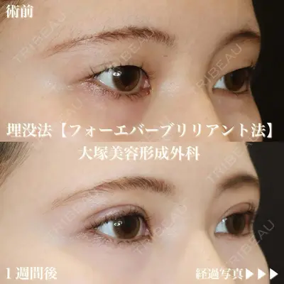 大塚美容形成外科 銀座本院の症例