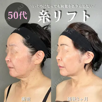 アリエル美容クリニック 大宮院 鈴木　桂介医師の症例