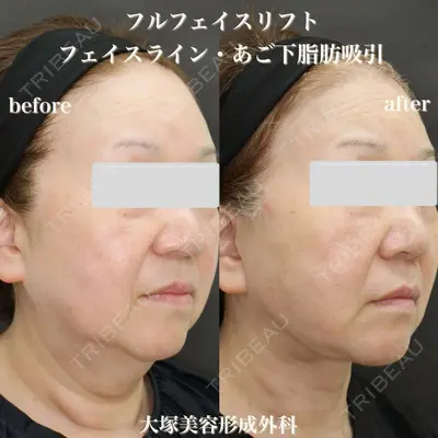 大塚美容形成外科 銀座本院 石井秀典医師の症例