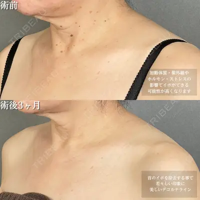 アリエル美容クリニック 大宮院 鈴木　桂介医師の症例