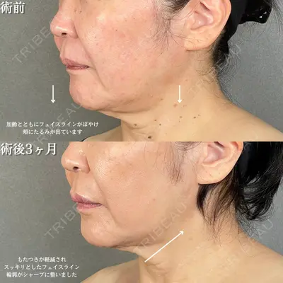 アリエル美容クリニック 大宮院 鈴木　桂介医師の症例