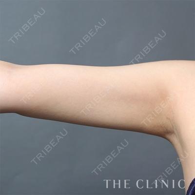 THE CLINIC（ザ・クリニック） 東京院の症例