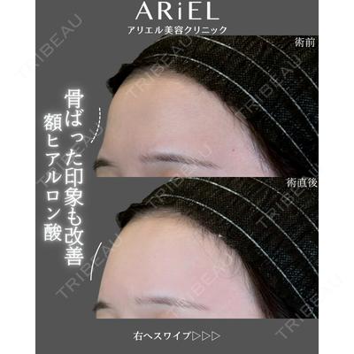 アリエル美容クリニック 郡山院 安齋 誠基医師の症例