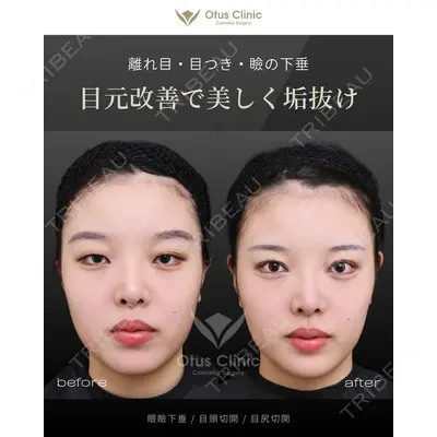 Otus Clinic 【オータスクリニック】 中 徳太郎医師の症例