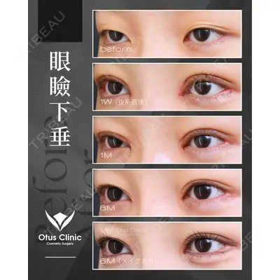 Otus Clinic 【オータスクリニック】 中 徳太郎医師の症例