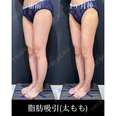 HAAB×DREAM BEAUTY CLINIC 東京本院 吉岡 修一医師の症例