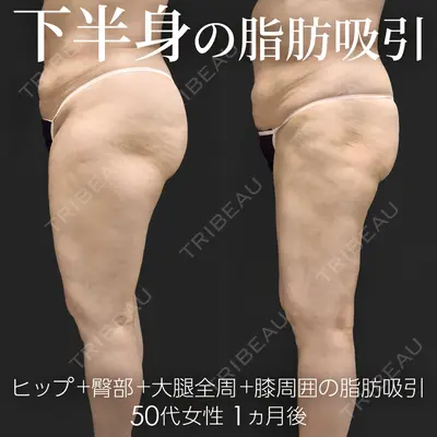 ジョウクリニック 高知院 溝渕　貴俊医師の症例