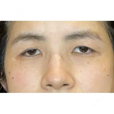 お茶の水美容形成クリニック 吉井 健吾医師の症例