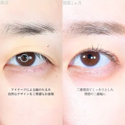 アリエル美容クリニック 大宮院 鈴木　桂介医師の症例