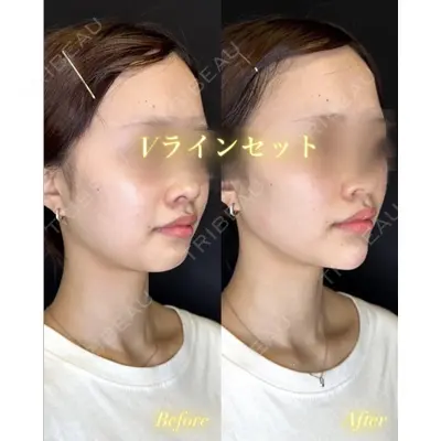ルラ美容クリニック 京都院の症例
