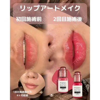 M'sクリニック【エムズクリニック】 永山　詩織（アートメイク施術者）医師の症例