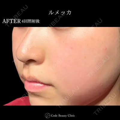 Code Beauty Clinic 名古屋院 橋本 祥平医師の症例