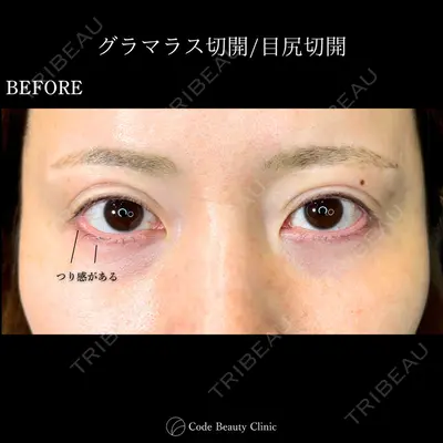 Code Beauty Clinic 名古屋院 橋本 祥平医師の症例