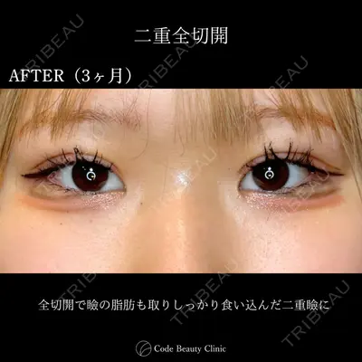 Code Beauty Clinic 名古屋院 橋本 祥平医師の症例
