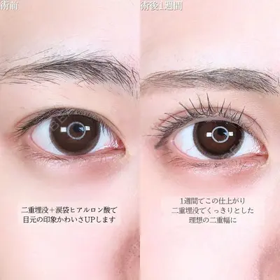 アリエル美容クリニック 大宮院 鈴木　桂介医師の症例